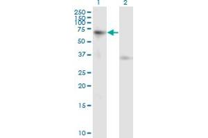 Activin A Receptor Type IB/ALK-4 Antikörper  (AA 24-126)