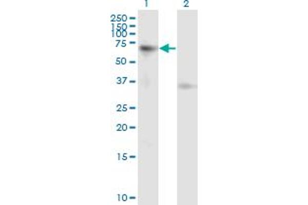 Activin A Receptor Type IB/ALK-4 Antikörper  (AA 24-126)