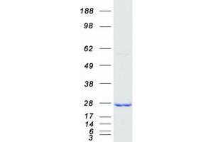 Western Blotting (WB) image for Superoxide Dismutase 2, Mitochondrial (SOD2) (Transcript Variant 1) protein (Myc-DYKDDDDK Tag) (ABIN2712377)