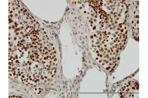 Image no. 1 for anti-PC4 and SFRS1 Interacting Protein 1 (PSIP1) (AA 1-51) antibody (ABIN599171) (PSIP1 Antikörper  (AA 1-51))