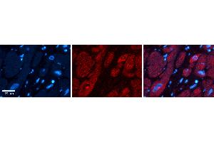 Rabbit Anti-UPF1 Antibody   Formalin Fixed Paraffin Embedded Tissue: Human heart Tissue Observed Staining: Cytoplasmic, nucleus Primary Antibody Concentration: 1:100 Other Working Concentrations: N/A Secondary Antibody: Donkey anti-Rabbit-Cy3 Secondary Antibody Concentration: 1:200 Magnification: 20X Exposure Time: 0.