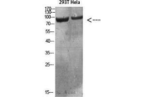 Western Blot (WB) analysis of specific cells using Antibody diluted at 1:1000. (IL4 Receptor Antikörper)