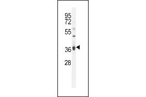 KLHL35 Antibody (C-term) (ABIN656072 and ABIN2845420) western blot analysis in MDA-M cell line lysates (35 μg/lane). (KLHL35 Antikörper  (C-Term))