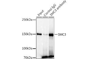 Immunoprecipitation analysis of 300 μg extracts of U-87MG cells using 3 μg SMC3 antibody (ABIN7270616). (SMC3 Antikörper)