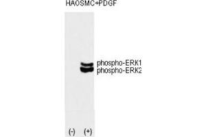 Western Blotting (WB) image for anti-Mitogen-Activated Protein Kinase 1/3 (MAPK1/3) (pThr202), (pTyr204) antibody (ABIN3001885) (ERK1/2 Antikörper  (pThr202, pTyr204))