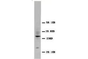Western blot analysis of rat tissue sections (spleen) using CD40L antibody (CD40 Ligand Antikörper  (N-Term))