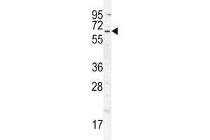 cIAP2 antibody western blot analysis in A549 lysate (BIRC3 Antikörper  (AA 101-131))