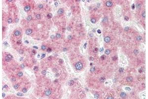 Human Liver (formalin-fixed, paraffin-embedded) stained with IRF3 antibody ABIN337252 at 1:50 followed by biotinylated goat anti-rabbit IgG secondary antibody ABIN481713, alkaline phosphatase-streptavidin and chromogen. (IRF3 Antikörper)