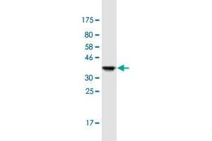 Western Blotting (WB) image for anti-UDP Glucuronosyltransferase 2 Family, Polypeptide B7 (UGT2B7) (AA 69-157) antibody (ABIN1774881)