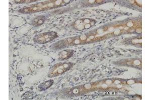 Image no. 1 for anti-Mitogen-Activated Protein Kinase Kinase Kinase 4 (MAP3K4) (AA 1201-1300) antibody (ABIN598812) (MAP3K4 Antikörper  (AA 1201-1300))
