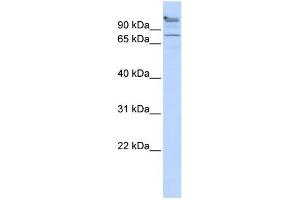 WB Suggested Anti-ZNF509 Antibody Titration:  0. (ZBTB49 Antikörper  (Middle Region))