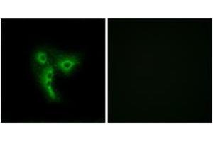 Immunofluorescence analysis of A549 cells, using OR4A4/4A47 Antibody. (OR4A4,4A47 (AA 250-299) Antikörper)