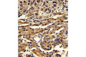 Immunohistochemistry (IHC) image for anti-ATP-Binding Cassette, Sub-Family G (WHITE), Member 1 (ABCG1) antibody (ABIN3002669) (ABCG1 Antikörper)