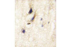 Formalin-fixed and paraffin-embedded human brain tissue reacted with DAAM1 Antibody , which was peroxidase-conjugated to the secondary antibody, followed by DAB staining. (DAAM1 Antikörper  (C-Term))