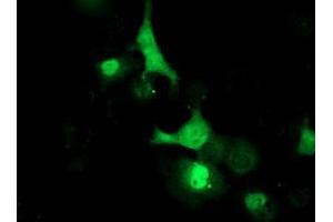 Anti-LCMT1 mouse monoclonal antibody (ABIN2454753) immunofluorescent staining of COS7 cells transiently transfected by pCMV6-ENTRY LCMT1 (RC200018). (LCMT1 Antikörper)
