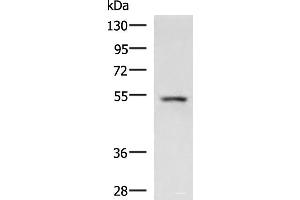 Western blot analysis of Rat liver tissue lysate using ONECUT1 Polyclonal Antibody at dilution of 1:600 (ONECUT1 Antikörper)