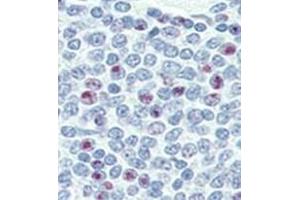 Image no. 2 for anti-Nanog Homeobox (NANOG) (AA 25-54), (N-Term) antibody (ABIN357014) (Nanog Antikörper  (N-Term))