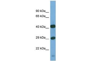Host:  Rabbit  Target Name:  SGSH  Sample Type:  PANC1 Whole Cell lysates  Antibody Dilution:  1. (SGSH Antikörper  (C-Term))