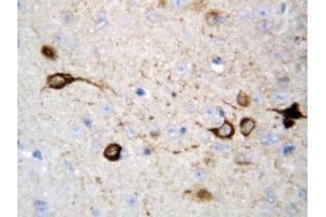 Anti-CAMKK2 antibody, IHC(P) IHC(P): Rat Brain Tissue (CAMKK2 Antikörper  (Middle Region))