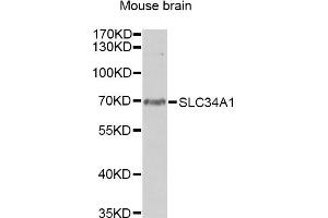 Western blot analysis of extracts of mouse brain, using SLC34A1 antibody. (Solute Carrier Family 34 (Type II Sodium/phosphate Contransporter), Member 1 (SLC34A1) Antikörper)