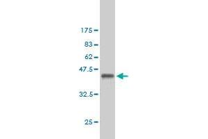 Western Blot detection against Immunogen (36. (Exportin 2 Antikörper  (AA 872-971))
