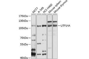 Western blot analysis of extracts of various cell lines, using UTP14A antibody  at 1:1000 dilution. (UTP14A Antikörper  (AA 1-260))