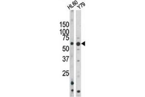 Western Blotting (WB) image for anti-RAD9 Homolog A (S. Pombe) (RAD9A) (pSer328) antibody (ABIN3001777) (RAD9A Antikörper  (pSer328))
