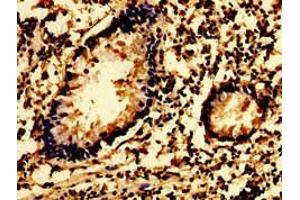 Immunohistochemistry of paraffin-embedded human appendix tissue using ABIN7174068 at dilution of 1:100 (SYK Antikörper  (AA 260-361))