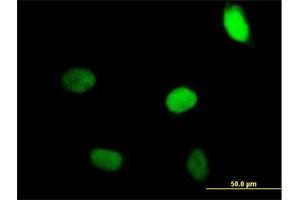 Immunofluorescence of purified MaxPab antibody to ZNF35 on HeLa cell. (ZNF35 Antikörper  (AA 1-519))