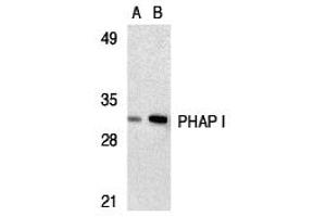 Western Blotting (WB) image for anti-PHAP I (C-Term) antibody (ABIN1030578) (PHAP I Antikörper  (C-Term))