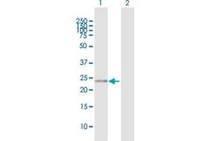 Western Blot analysis of RANBP1 expression in transfected 293T cell line by RANBP1 MaxPab polyclonal antibody. (RANBP1 Antikörper  (AA 1-201))