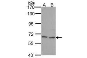 Image no. 1 for anti-Polynucleotide Kinase 3'-Phosphatase (PNKP) (AA 1-243) antibody (ABIN467497) (PNKP Antikörper  (AA 1-243))