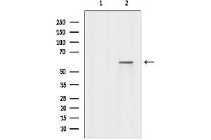 Western blot analysis of lysates from Mouse spleen, using RABEP2 Antibody.