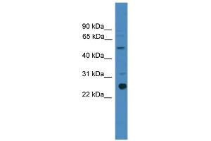 WB Suggested Anti-ZMAT2 Antibody Titration:  0. (ZMAT2 Antikörper  (Middle Region))