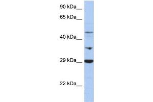 WB Suggested Anti-PDK3 Antibody Titration:  0.