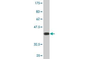 Western Blot detection against Immunogen (37. (MXI1 Antikörper  (AA 73-182))