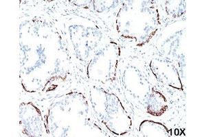 IHC staining of human prostate (10X) with HMW Cytokeratin antibody (34bE12). (KRT1 Antikörper)