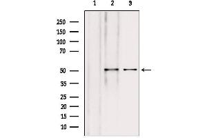 Western blot analysis of extracts from various samples, using NAPRT1 antibody. (NAPRT1 Antikörper  (Internal Region))