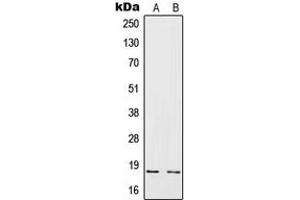Western blot analysis of IL-4 expression in HeLa (A), Raji (B) whole cell lysates. (IL-4 Antikörper  (Center))