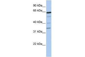 WB Suggested Anti-GALNTL1 Antibody Titration:  0. (GALNTL1 Antikörper  (N-Term))