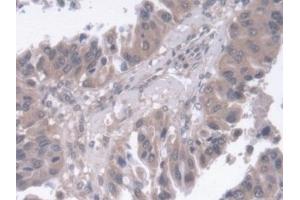 Immunohistochemistry (IHC) image for anti-Regucalcin (RGN) (AA 65-299) antibody (ABIN7440923)