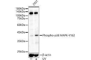 Western blot analysis of extracts of various cell lines, using Phospho-p38 MAPK-Y182 antibody (ABIN3023585, ABIN3023586, ABIN3023587 and ABIN6225421) at 1:500 dilution.