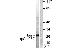Immunohistochemistry analysis of paraffin-embedded human pancreas tissue using 14-3-3 θ/τ (Phospho-Ser232) antibody. (14-3-3 theta Antikörper  (pSer232))