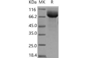 Western Blotting (WB) image for HEPACAM Family Member 2 (HEPACAM2) protein (Fc Tag) (ABIN7321175) (HEPACAM2 Protein (Fc Tag))