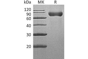 Western Blotting (WB) image for Lymphocyte Antigen 9 (CD229) protein (His tag) (ABIN7320715)