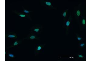 Immunofluorescence of purified MaxPab antibody to MCM5 on HeLa cell. (MCM5 Antikörper  (AA 1-734))