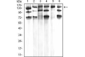 Western Blotting (WB) image for anti-phospholipase C, gamma 1 (PLCG1) (AA 1192-1291) antibody (ABIN5933333) (Phospholipase C gamma 1 Antikörper  (AA 1192-1291))