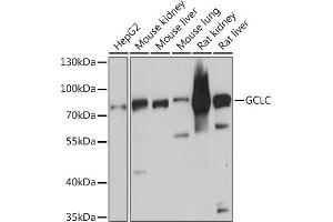 Western blot analysis of extracts of various cell lines, using GCLC antibody (ABIN6130444, ABIN6141016, ABIN6141017 and ABIN6214615) at 1:3000 dilution. (GCLC Antikörper  (AA 1-252))