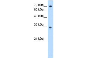 WB Suggested Anti-FCGRT Antibody Titration:  0. (FcRn Antikörper  (N-Term))