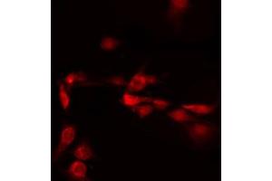 ABIN6272260 staining LOVO by IF/ICC. (C/EBP delta/epsilon Antikörper)